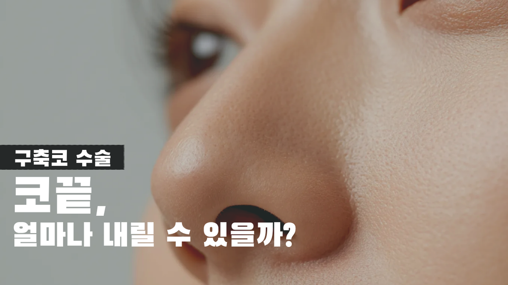 압구정구축코 썸네일